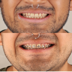 David Porras Dentista Chilpancingo