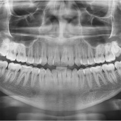 Dendix Laboratorio Digital De Radiología Dental