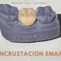 Dent Smile