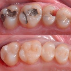 Denta Elite