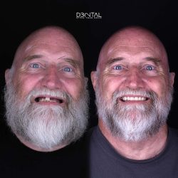 Dental 32