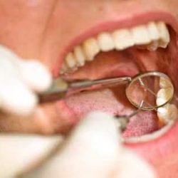 Dental Almeida