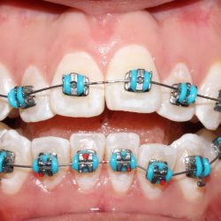 Dental Amos