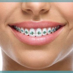 Dental Artex Clínica Dental Dentistas En Guadalajara Zona Joyas Del Nilo