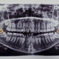 Dental Bella Vista Chilpancingo