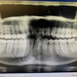 Dental Bueno Coacalco