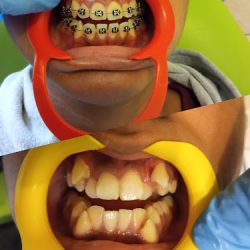 Dental 