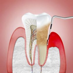 Dental Caf Dentista Cynthia Figueroa