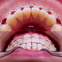 Dental Care Center Tuxtla