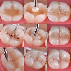 Dental Care