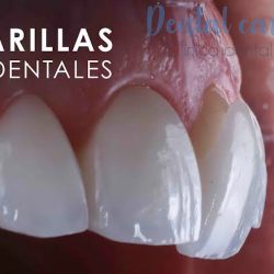Dental Care Zamora , Odontologia Estetica E Implantologia