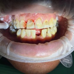 Dental Carrillo Y Asociados