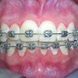 Dental Castrejon