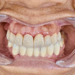 Dental Center Gómez Palacio. Prótesis Bucal Y Odontopediatria