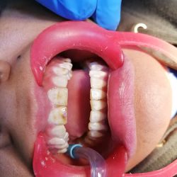 Dental Center Smile