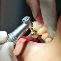 Dental Coral (consultorio Dental)