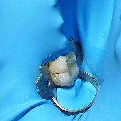Dental Corner