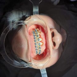 Dental Costa Rica