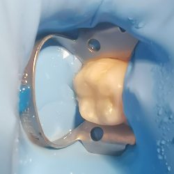 Dental Covsa