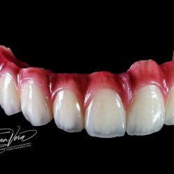 Dental Crew Mexico