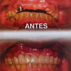 Dental De La Peña