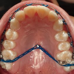 Dental De La Torre