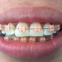 Dental De Tabasco