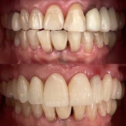 Dental Delgado Acapulco
