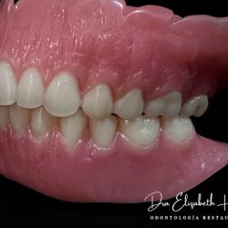 Dental Design