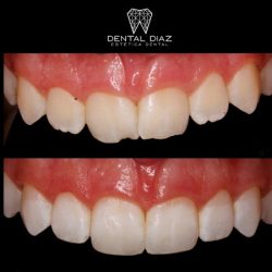 Dental Díaz Estética Dental