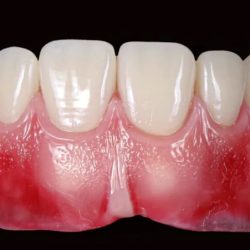 Dental Dream Teeth