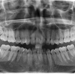 Dental Esve 