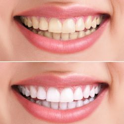 Dental Ética