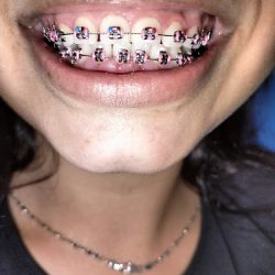 Dental Eugenia