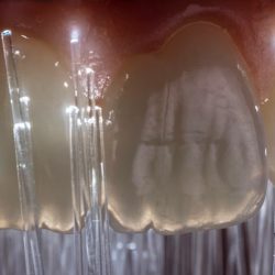 Dental Excellence