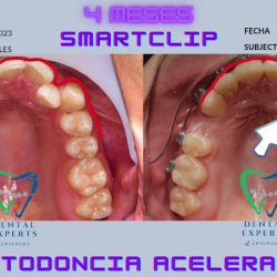 Dental Experts Ensenada