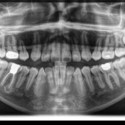 Dental Family