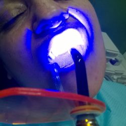 Dental Ferpa