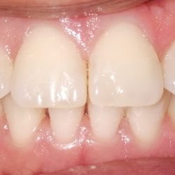 Dental Flores