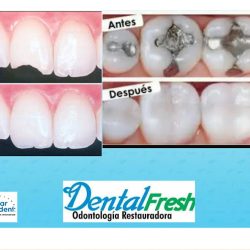 Negocio Dental Fresh