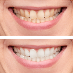 Dental Go
