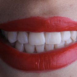 Dental Haciendas