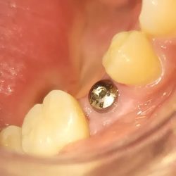 Dental Health Mx