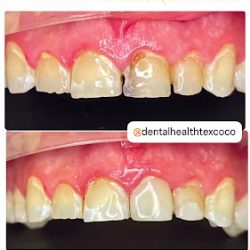 Dental Health Texcoco