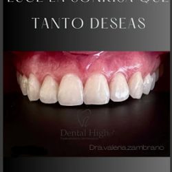 Dental High Vz