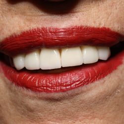 Dental In