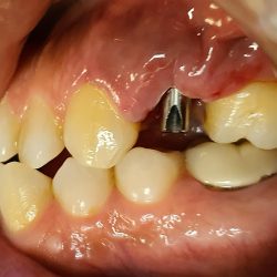 Dental In