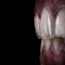 Dental In