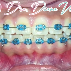 Dental Inn - Nezahualcoyotl