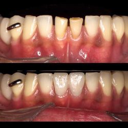 Dental Inn Tecamac